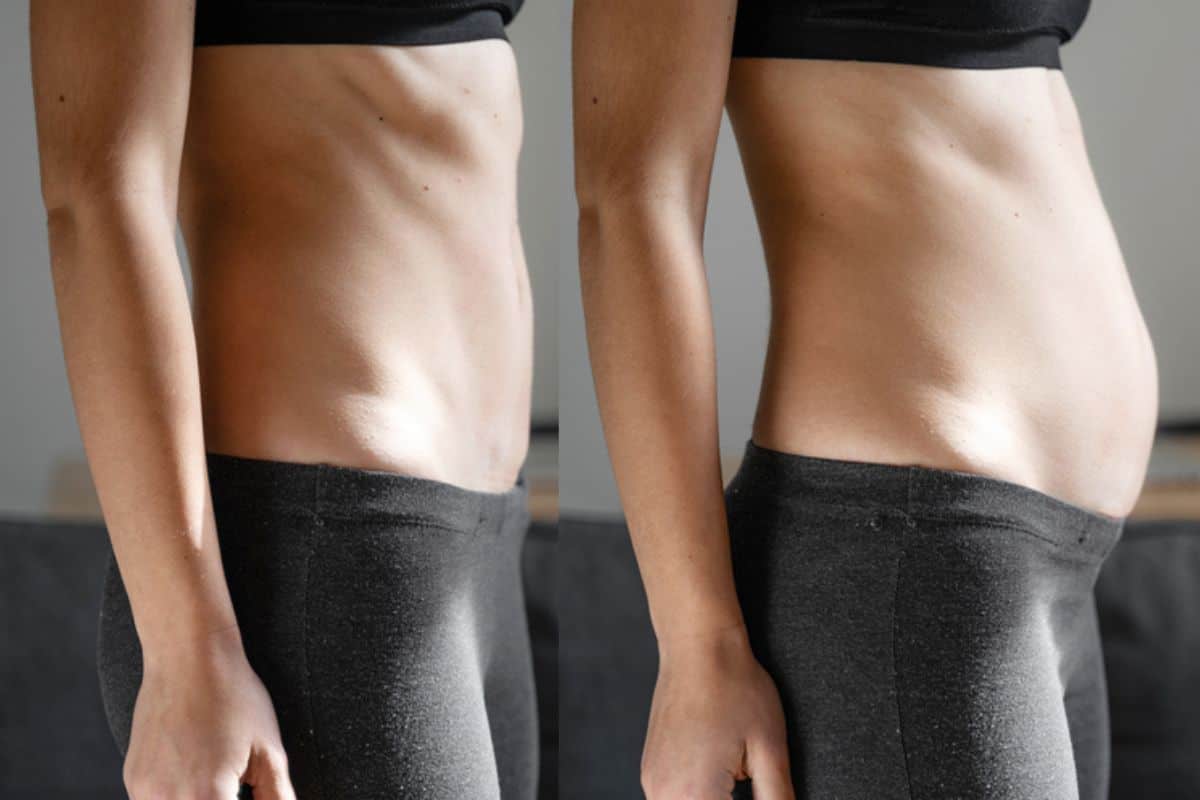 How long does diastasis recti take to improve Minehead?