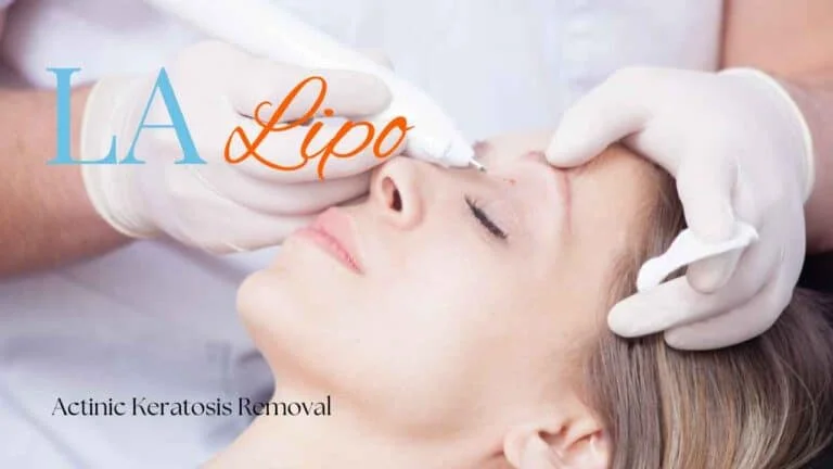 Woman receiving Actinic Keratosis Removal Treatment Minehead