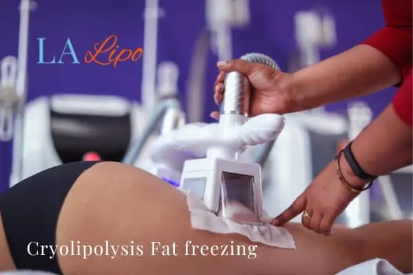 women getting fat freezing Minehead